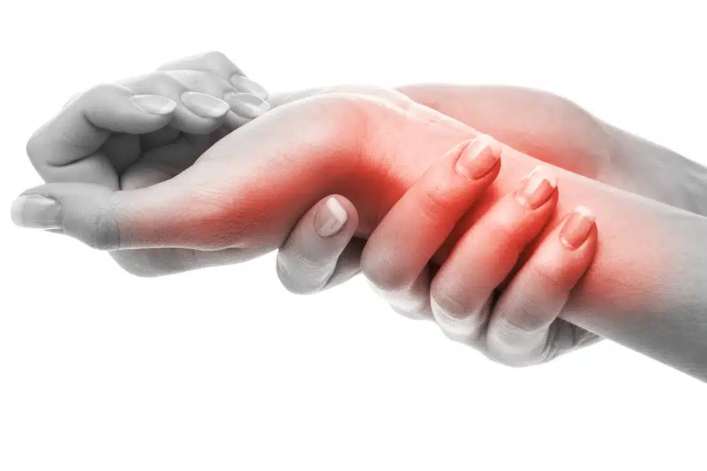 Rheumatoid Arthritis